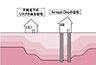 その他：【安心の土台作り】地盤調査結果に基づき地盤改良（補強）工事を実施。スウェーデン式サウンディング試験を行い、地盤調査データに基づき、この地盤の共通杭を選定し使用するなどして、地盤改良を行います
